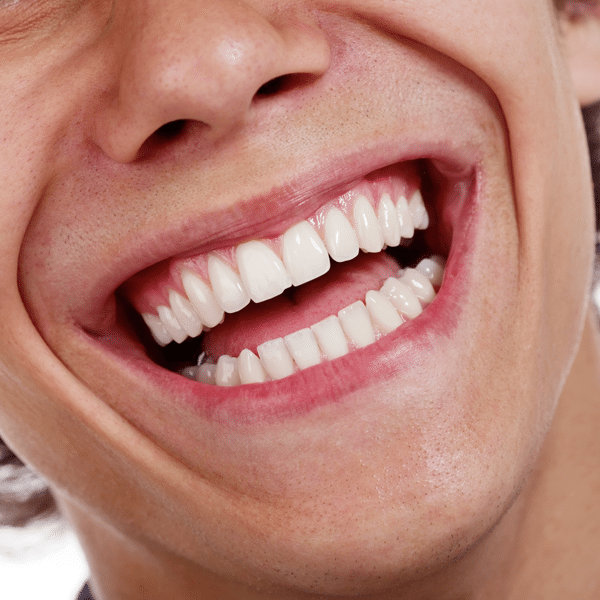 close up young man's smile