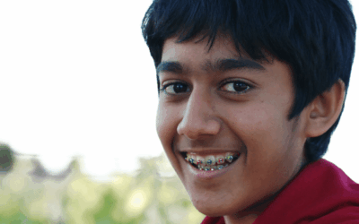 The Health Benefits Behind Braces