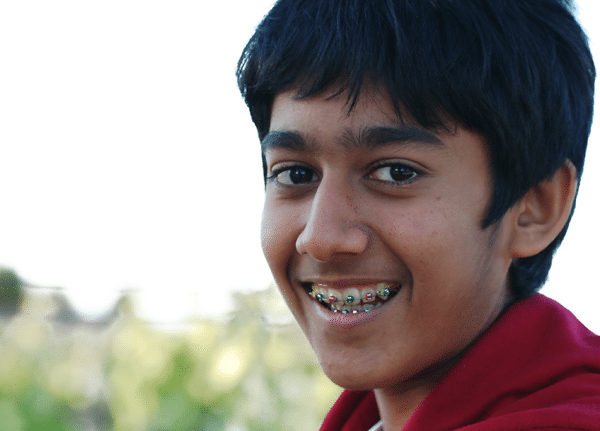 teen wearing braces in Sacramento