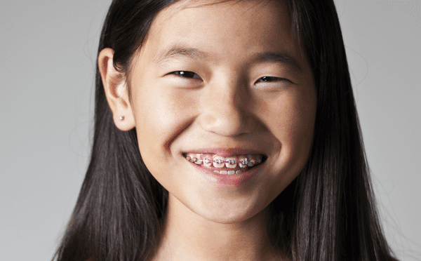 pre-teen girl wearing braces