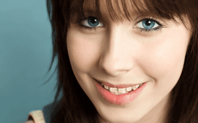 The Cost of Orthodontic Treatment