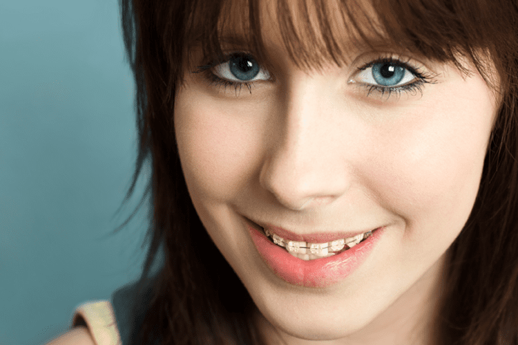 Closeup of teen girl wearing braces