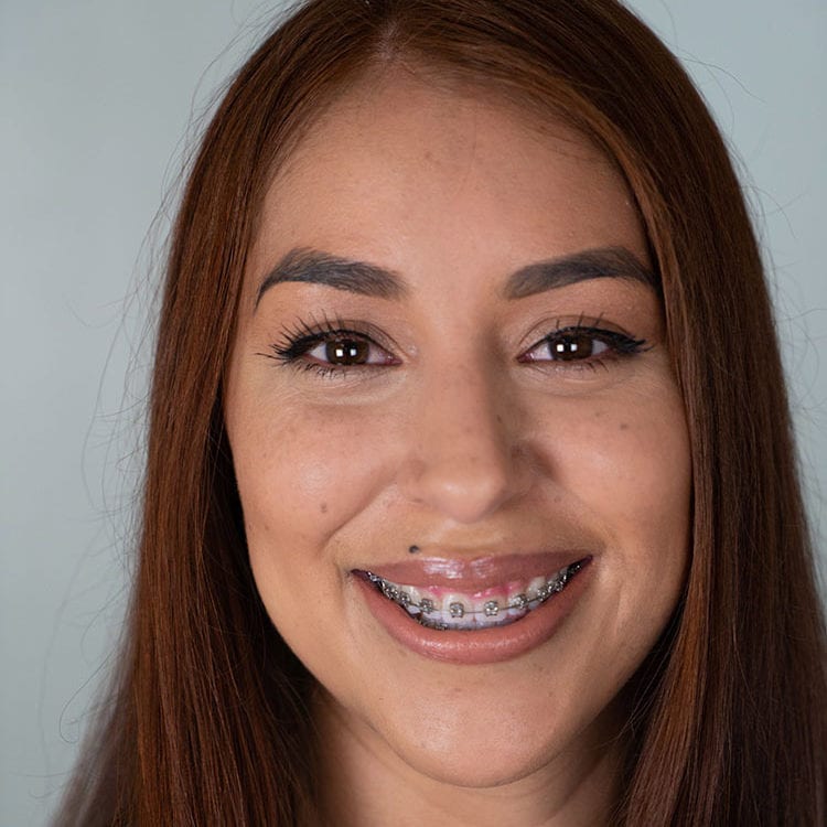 Lily L., Dental Assistant, American River Orthodontics