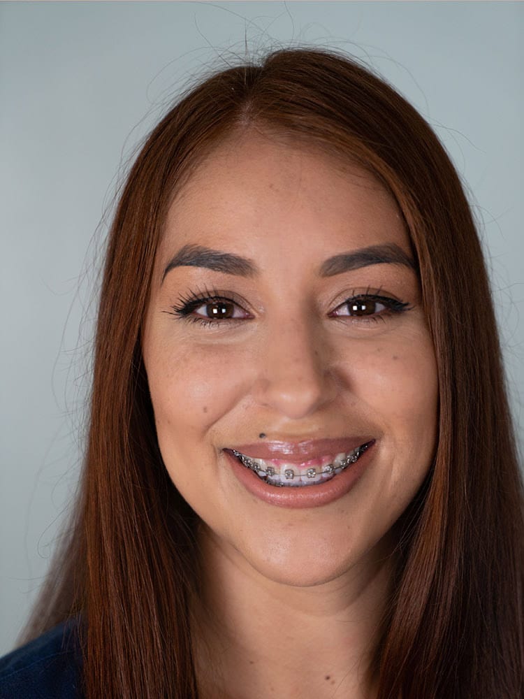 Lily L., Dental Assistant, American River Orthodontics