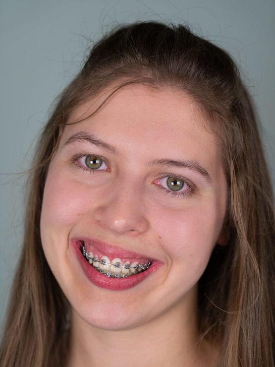 Simona, Orthodontic Assistant, American River Orthodontics