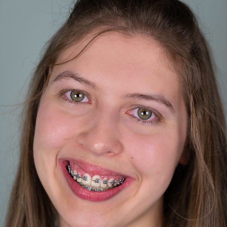 Simona, Orthodontic Assistant, American River Orthodontics