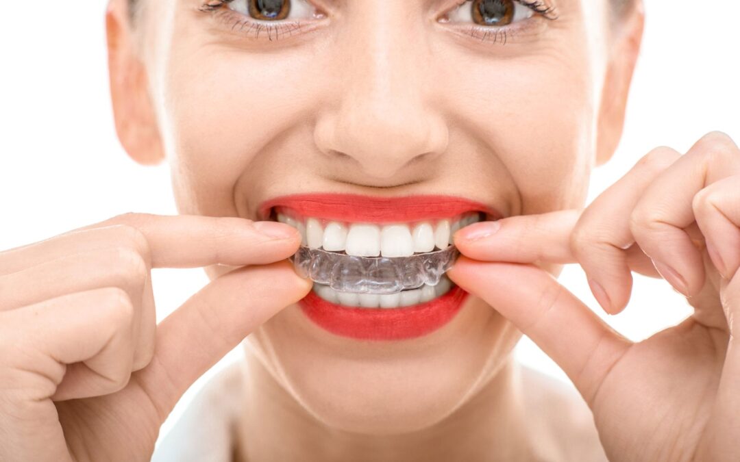 Average Cost of Invisalign in Sacramento