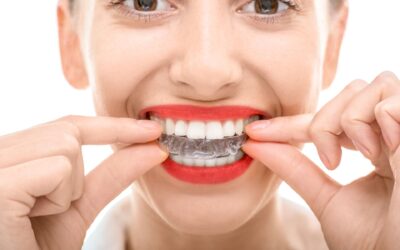 The Average Cost Of Invisalign