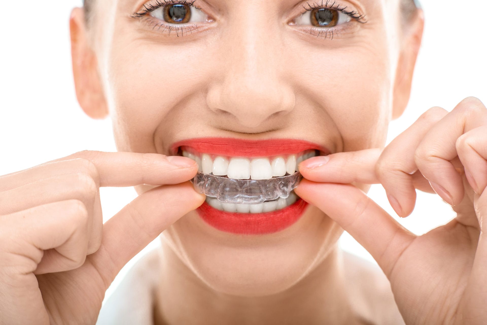 close up of woman inserting a clear aligner