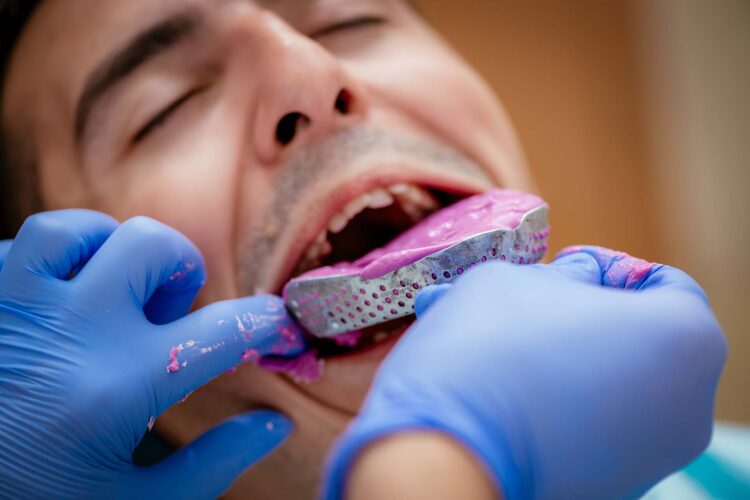 avoid disgusting dental impressions with iTero 3D scanning