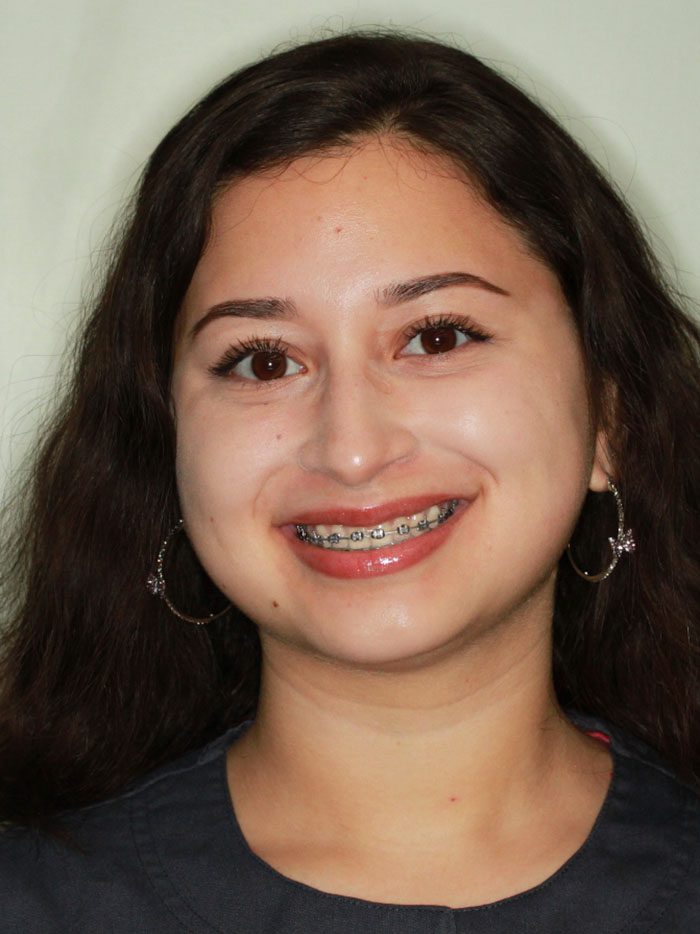 Layla is the dental assistant at American River Orthodontics in Sacramento