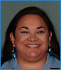 Athena's smile after orthodontic treatment Athena after orthodontic treatment