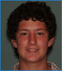 Calvin's smile before treatment with Dr. Payne Calvin's smile before treatment with Dr. Payne