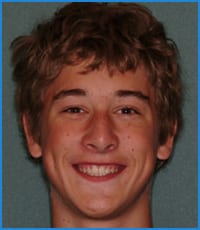 Chris' smile after treatment Chris' smile after straightening his teeth