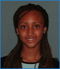 Earp before treatment Earp's smile before fixing her bite with orthodontics