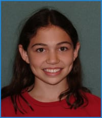 Gabrielle before treatment Gabrielle's smile before treatment