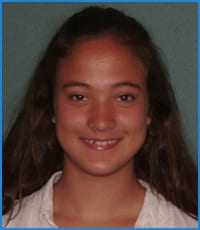 Kathryn before treatment Kathryn before treatment for crowding