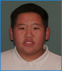 Lee before treatment Lee before treatment