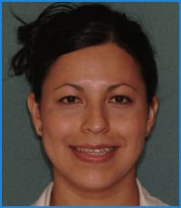 Margarita before treatment Margarita before treatment