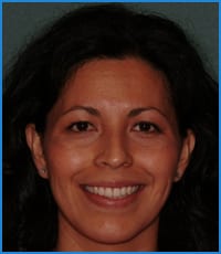 Margarita's smile after treatment Margarita after treatment