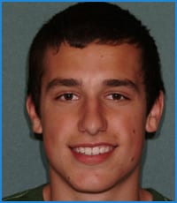 Ryan's smile after treatment Ryan after orthodontic treatment for a deep bite