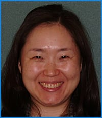 Sohyung's smile after treatment Sohyung after straightening her crowded teeth