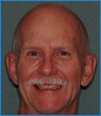 Stanley's smile after treatment Stanley after orthodontic treatment with Dr. Payne