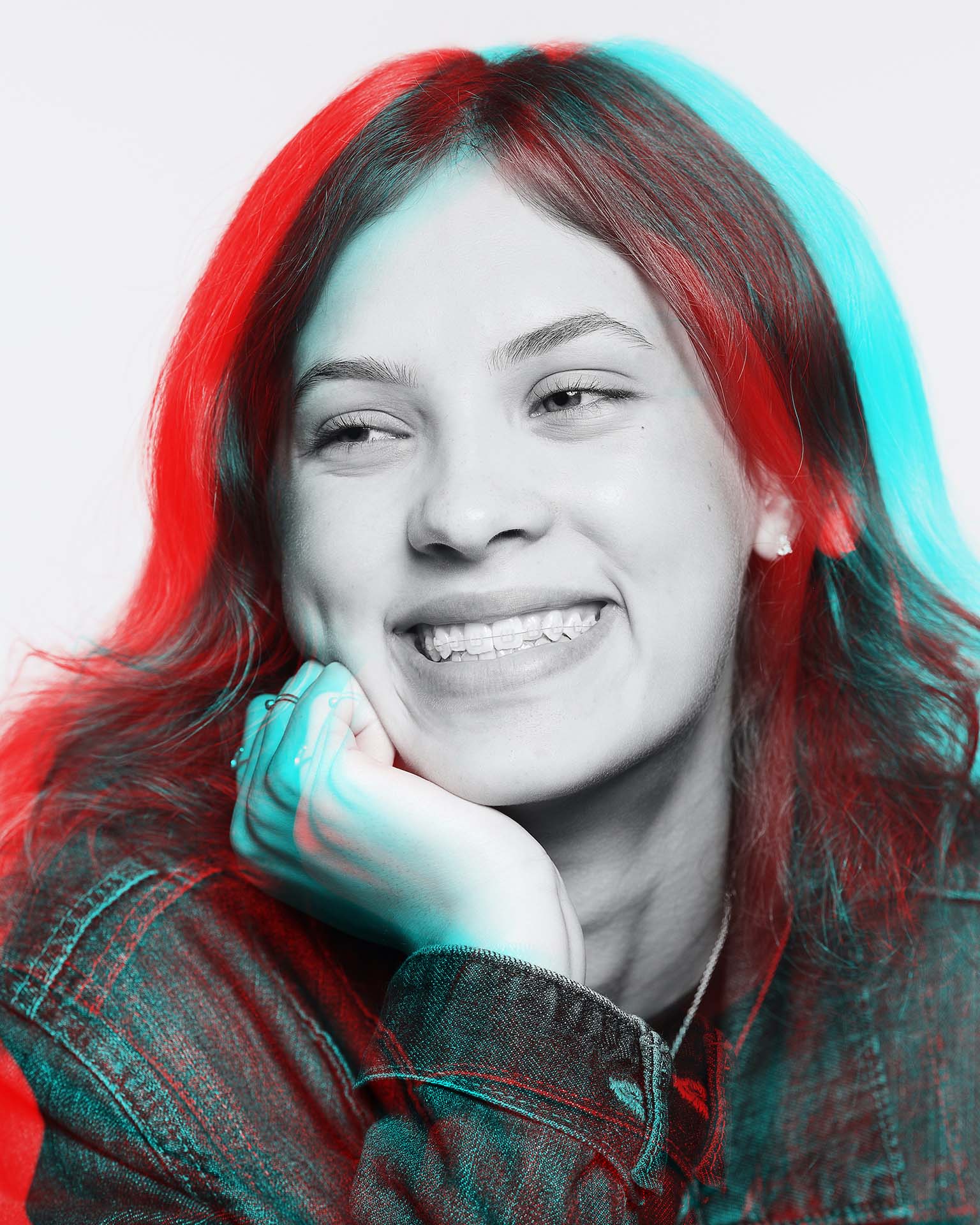 LightForce braces are a type of orthodontic treatment that utilizes 3D-printed, customized brackets for a more precise and potentially faster alignment of teeth Young lady showing off her LightForce braces