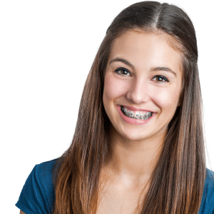 Woman smiling while putting on traditional metal braces. Comparing braces vs Invisalign? Learn about the pros and cons of each treatment.