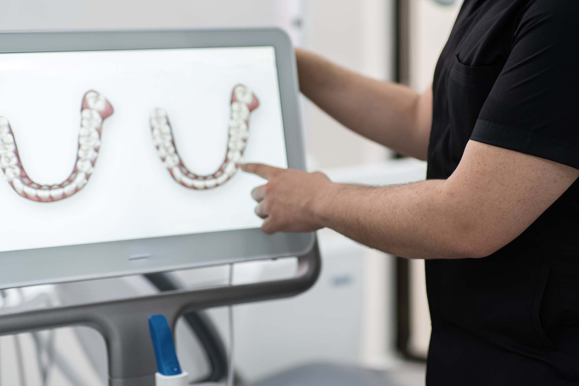 orthodontist explaining digital scan results to patient