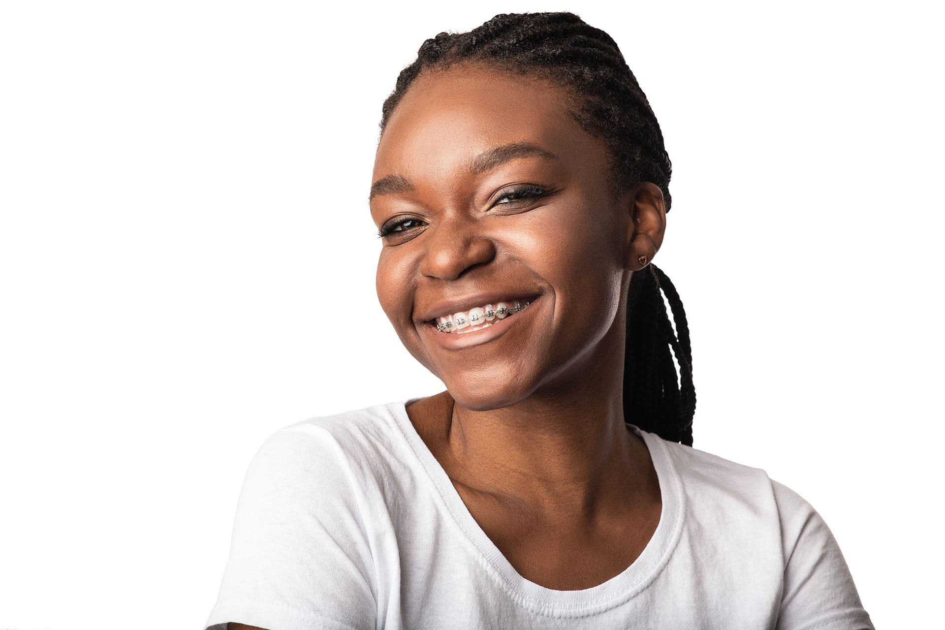 Arden Arcade girl with Damon braces, a great orthodontic treatment option