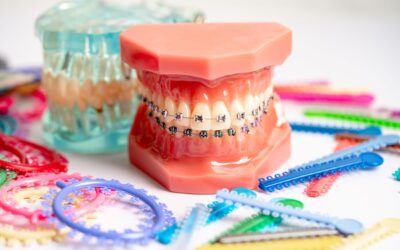 Orthodontic Emergencies: What’s Urgent, What Can Wait, and Quick Home Fixes