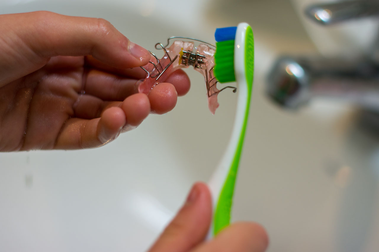 Your retainer needs regular maintenance and cleaning child's hands brushing retainer with a toothbrush