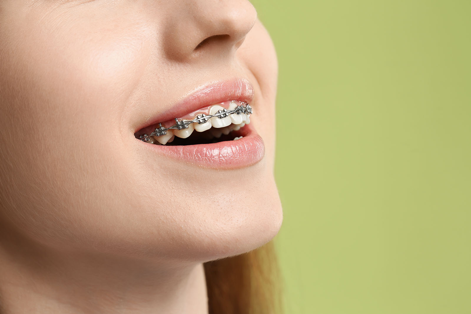 smiling young woman with braces in front of a green background